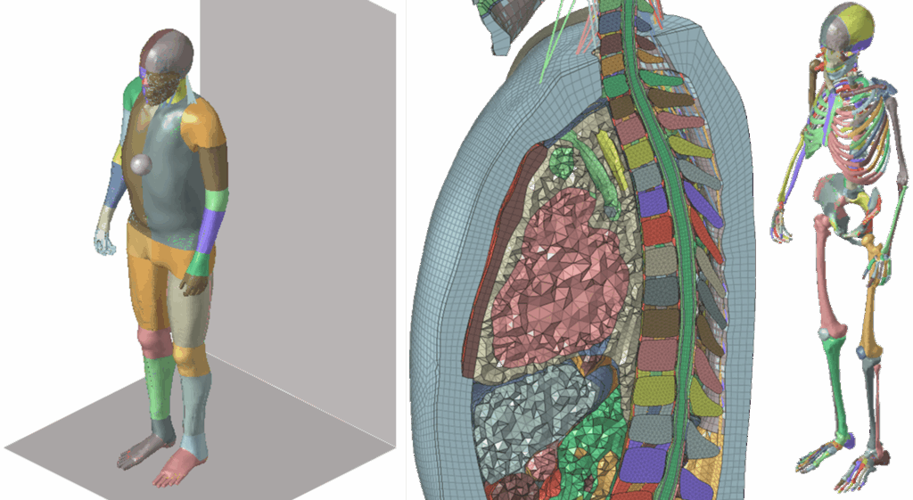 Reference Project: Structural Simulation of a Human Body Model - FiniteNow