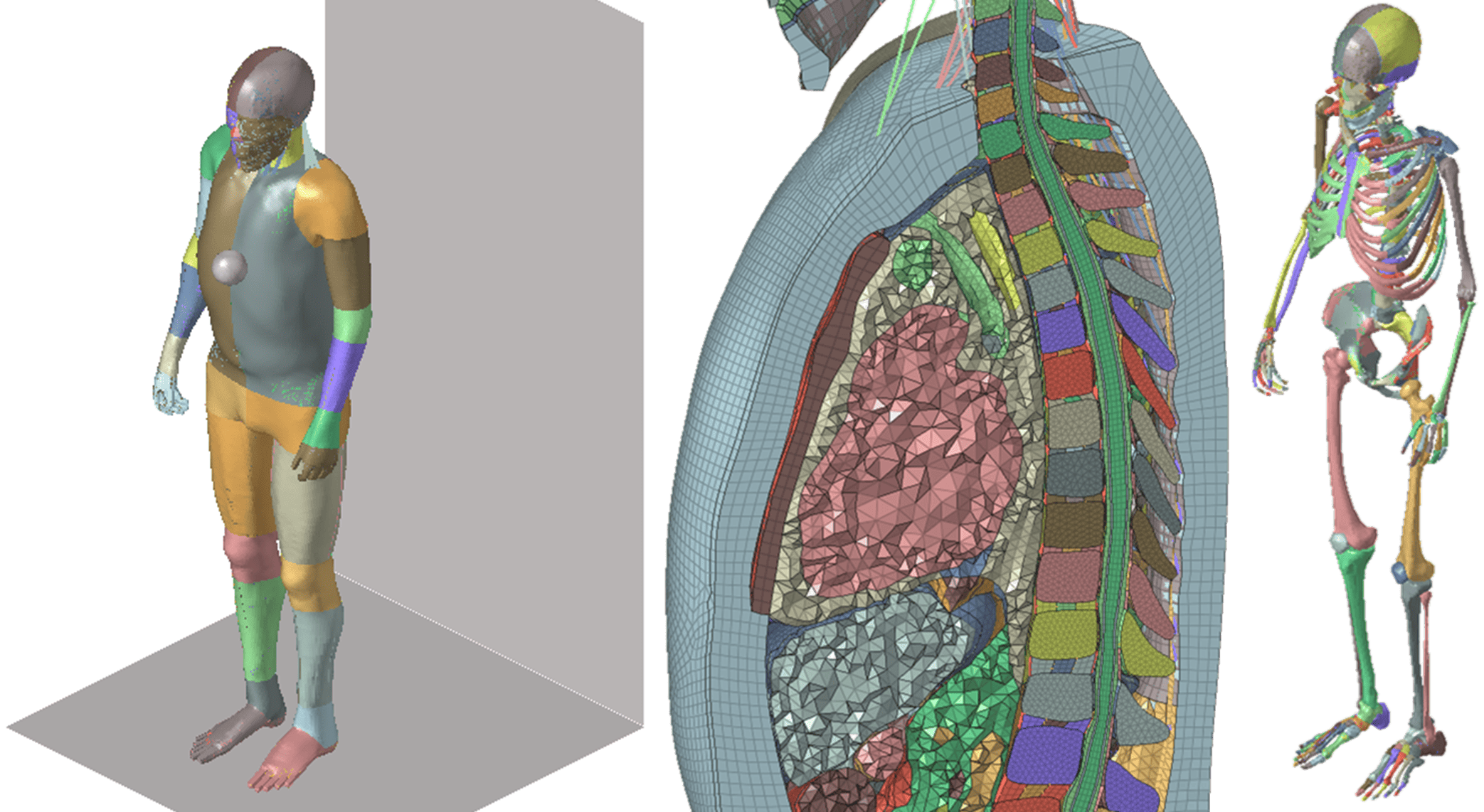 Finite Element Analysis of a Human Body